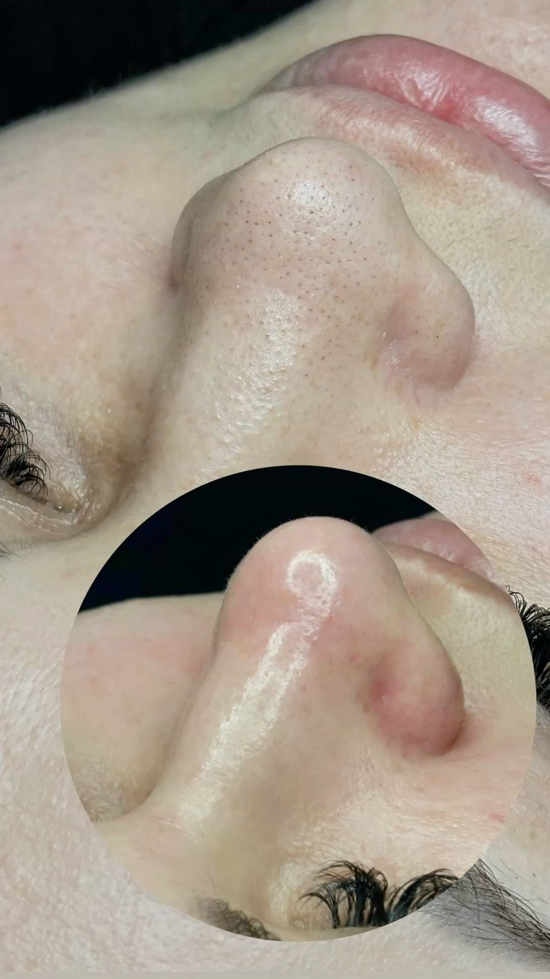 Маска від чорних цяток і